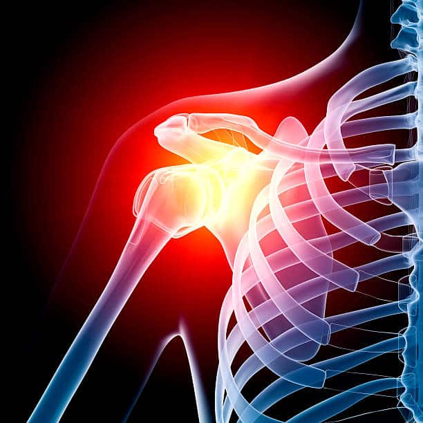 Holographic image of right shoulder, done in blue. The shoulder joint is bright red to signify pain and injury to rotator cuff.