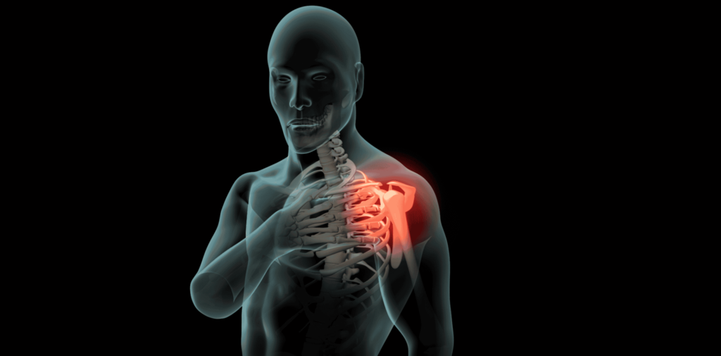 Holographic image of person with left shoulder pain. The person is holding their left shoulder with their right hand. The pain is displayed as red and intense.