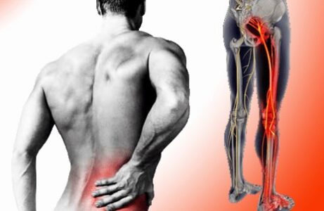 Picture of a man holding his lower back in pain. Side image of person's leg with the sciatic nerve in red to depict pain. Massage and chiropractic is an effective treatments.