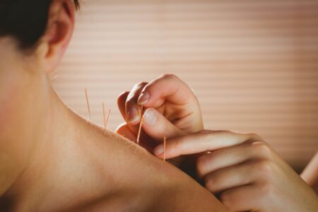 A young female patient is having acupuncture needles placed into her shoulder. The room is dimly lit for relaxation.