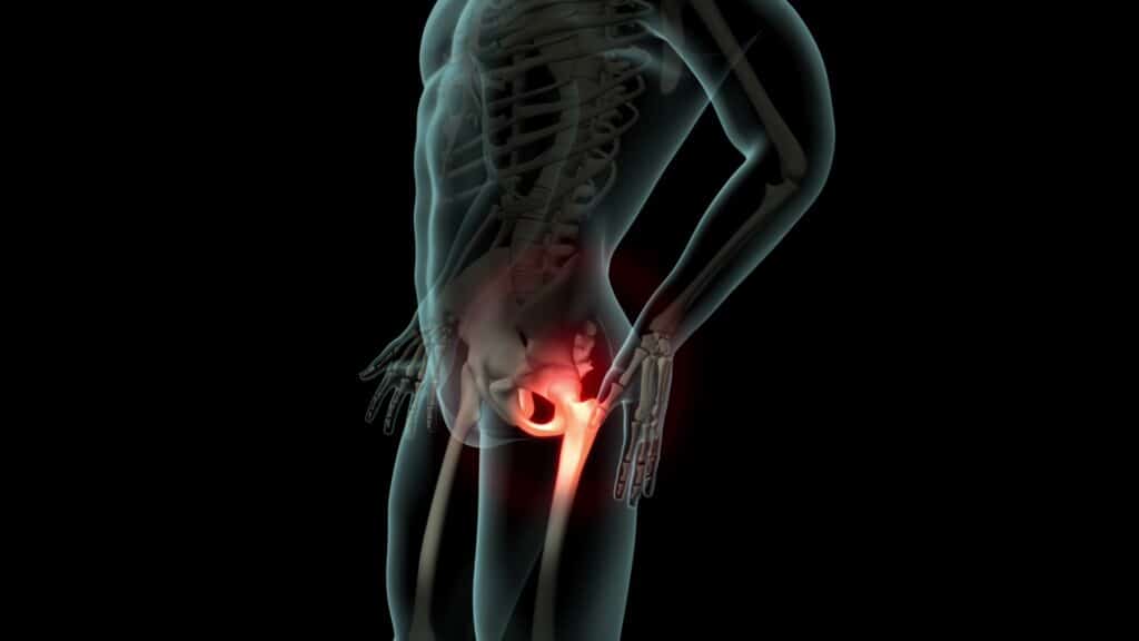 Holographic image of hip pain. Hip pain in red with outline of hip in black. Hip pain treatment.