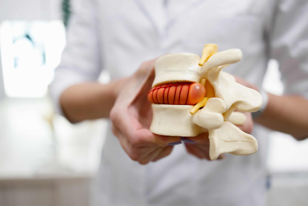 A doctor with a lumbar spine model explaining the key components of decompression therapy, highlighting the creation of negative pressure within spinal discs.