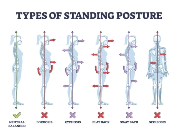 Standing posture, showing bad posture in 5 pictures and one posture of good posture. red arrows indicate bad standing posture.