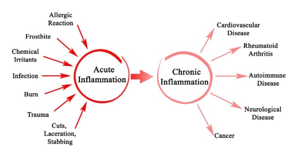 Infographic showing causes of acute inflammation. As well as the effects of chronic inflammation