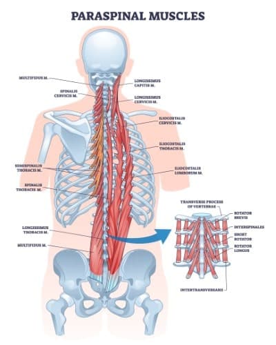 Lumbar spine anatomy, muscles, ligaments and tendons shown as a diagram.