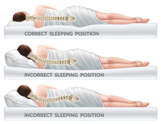 A lady is lying on a bed in three different postures. A correct posture shows a straight spine. The incorrect postures show curved spines