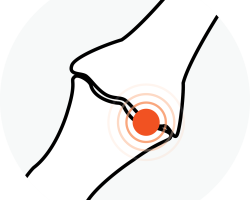 Pain in joint from arthritis. Drawing of two bones with red dot showing pain. Chiro near me treatment can help with arthritis.